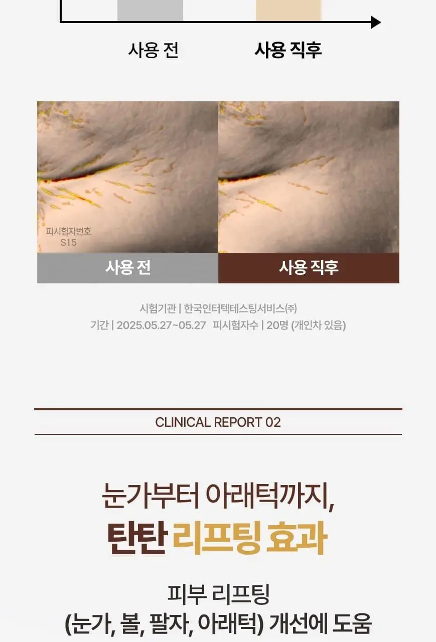 [화해어워드 1위/모공앰플] 닥터오라클 레티노타이트닝 비타민A 레티놀 앰플 50ml 상세페이지 26